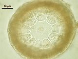 8 – Sezione trasversale di una zona nodale con 10 cellule periassiali